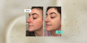 "Benefits of hyaluronic acid serum plump skin