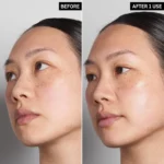 "Benefits of hyaluronic acid serum plump skin
